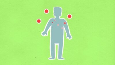 Rahasia Kesehatan Jiwa Raga: Dokter Ungkap, Anda Wajib Tahu!